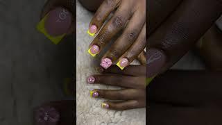 Ongles
