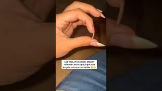 Ongles